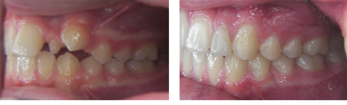 Greenwich Adult Orthodontist