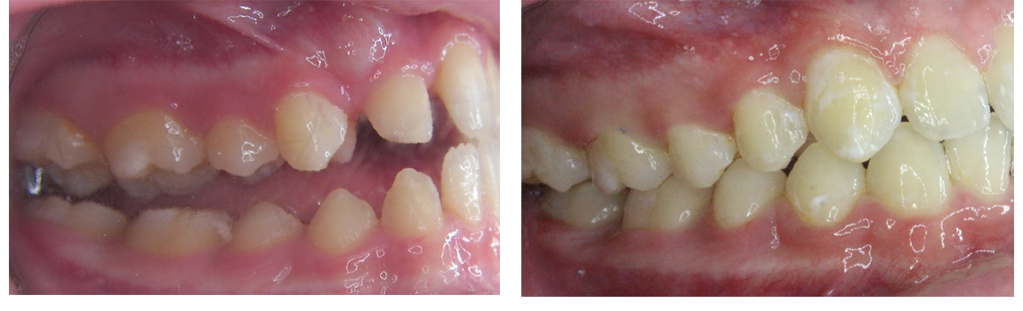 Children s Orthodontist in Greenwich