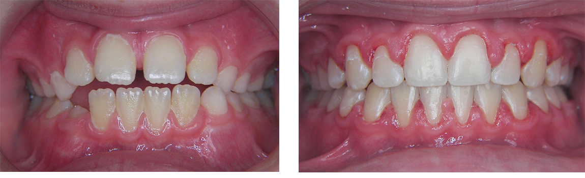 Orthodontist in Greenwich