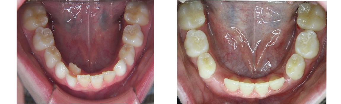 Greenwich Teen Orthodontist