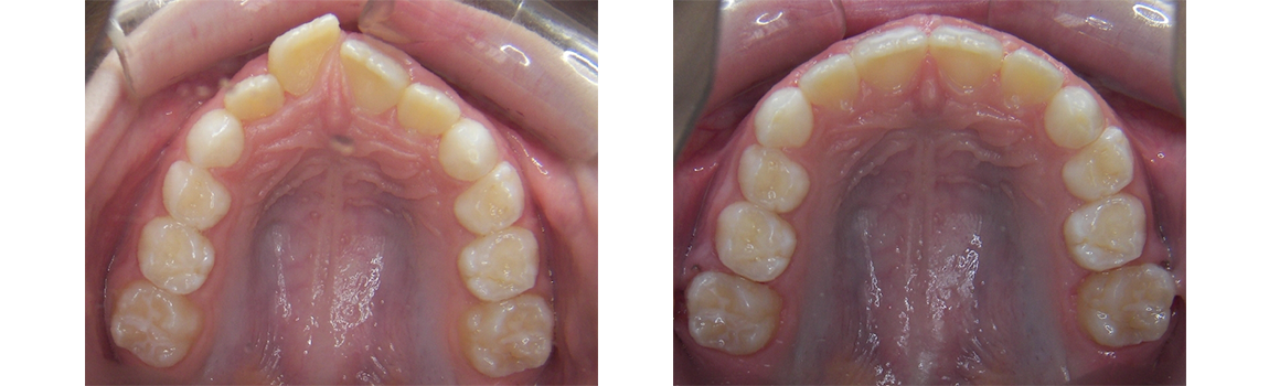 Pediatric Orthodontics in Greenwich